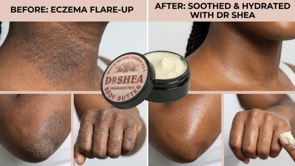 before and after using dr shea fragrance free body butter for sensitive skin